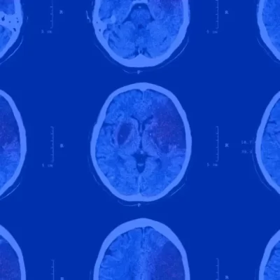 Neuralert background