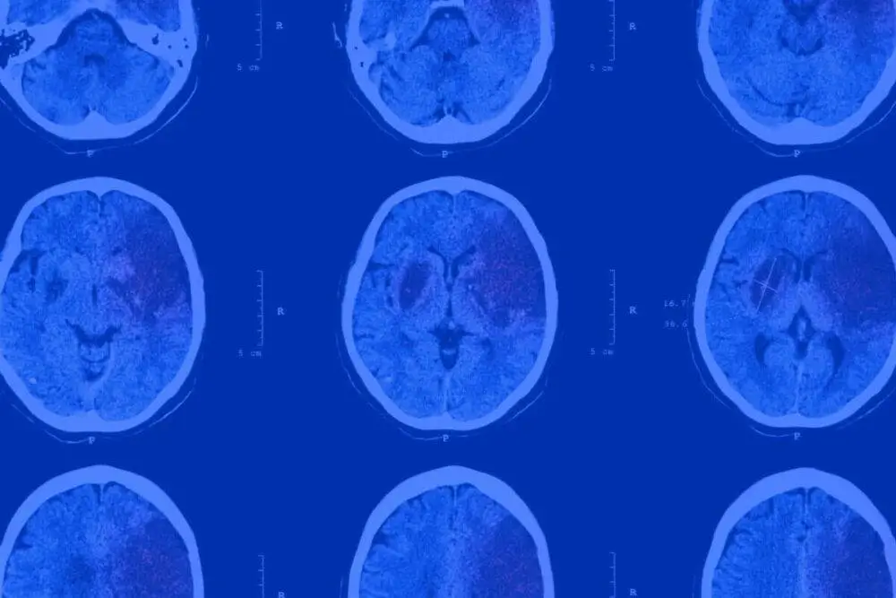 Neuralert background